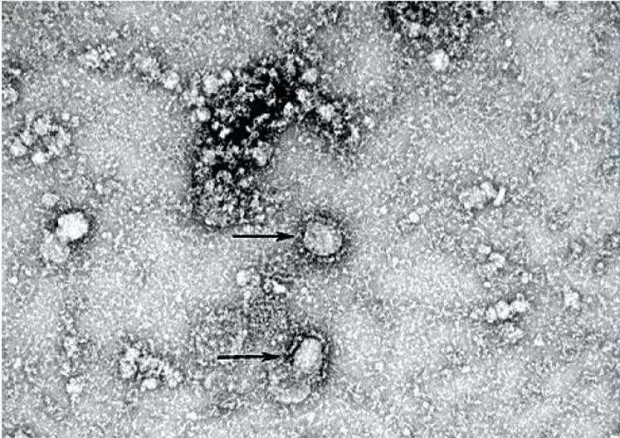 coronavirus